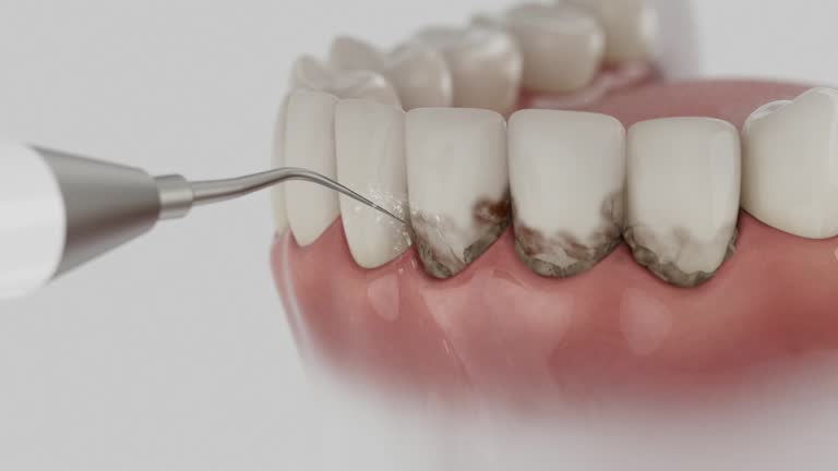 Trusted Teeth Cleaning And Checkup service in Brook Highland, AL - Dentist Open Now